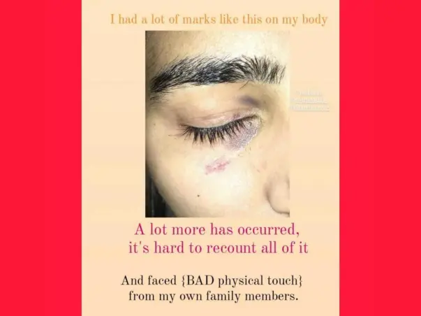 HELP NAVJOYT IN HER SURVIVAL & LIVLIHOOD
