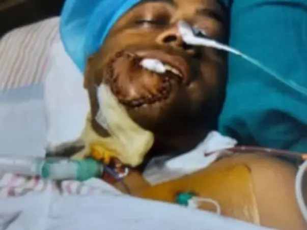 Support Rohit Kesarwani To Recover From Mouth Cancer