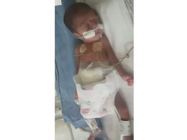 Help!! 27 weeks Premature Baby is in NICU, Family Need Help!!