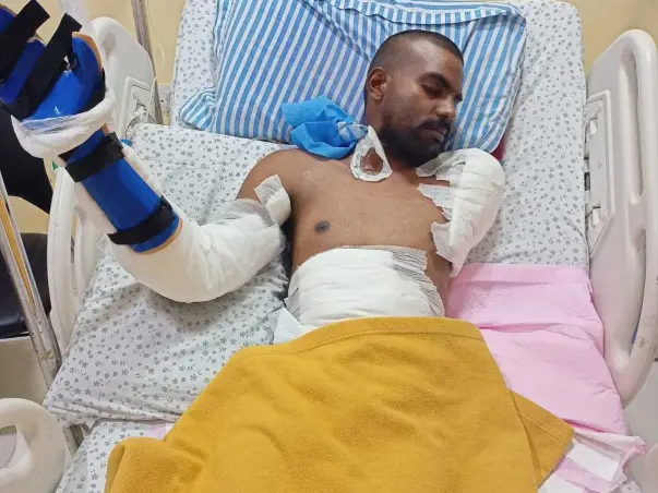Support K. Madhu Sudhana Chary Recover From Accidental Electric Shock