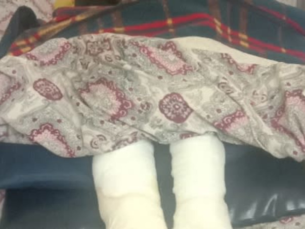 My Mother Is Struggling With Chronic Ulcer In Leg, Help Her