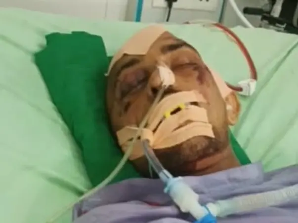 27 Years Old Mubbshir Needs Your Help Fight Major Head Injury Due To F