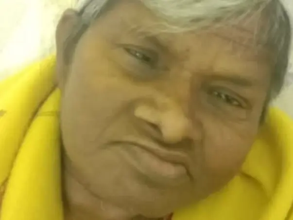 My Mother Is Struggling With Chronic Ulcer In Leg, Help Her