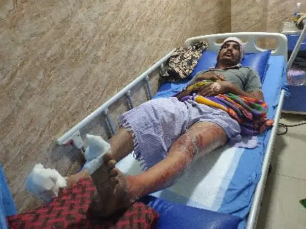Support Jalapathi Reddy Recover From Accidental Electric Shock