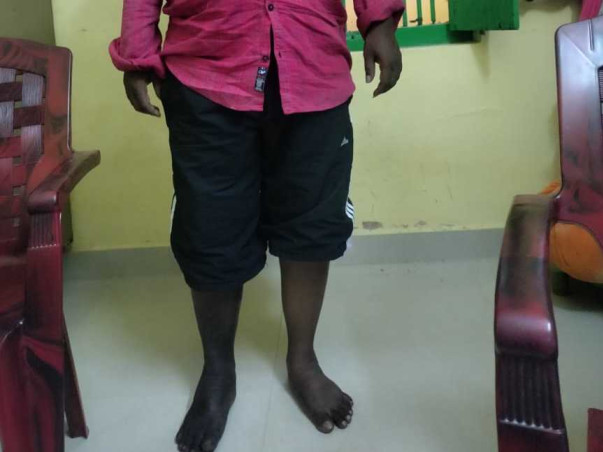 Please Support V Durga Prasad To Recover From Vascular Surgery