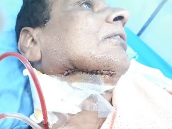 Help Satyanarayana Recover From Cancer