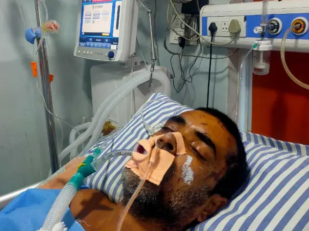 Help Save One Leg of Manoj Ji