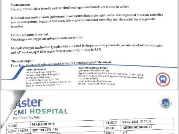 Help My Friend Mahesh To Recover From Lung Cancer