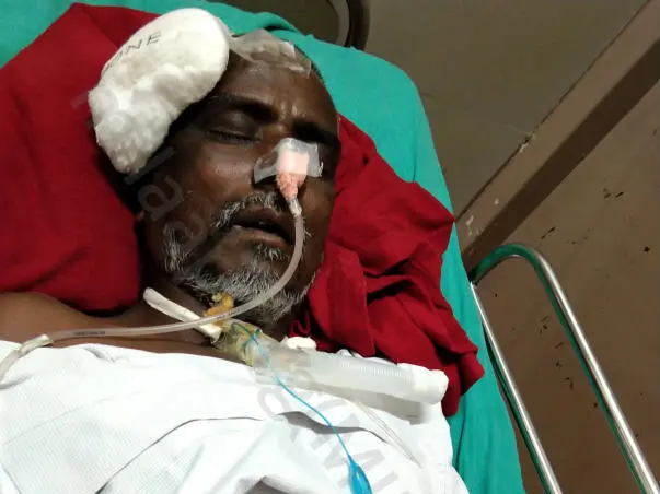 Kindly help Shankar to recover from brain injury!