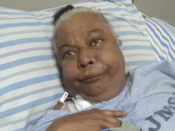 Help Ramala for Chronic kidney Disease