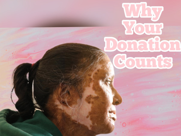 Help Empower Acid Attack Survivors