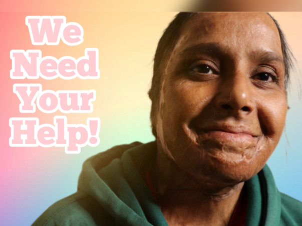 Help Empower Acid Attack Survivors