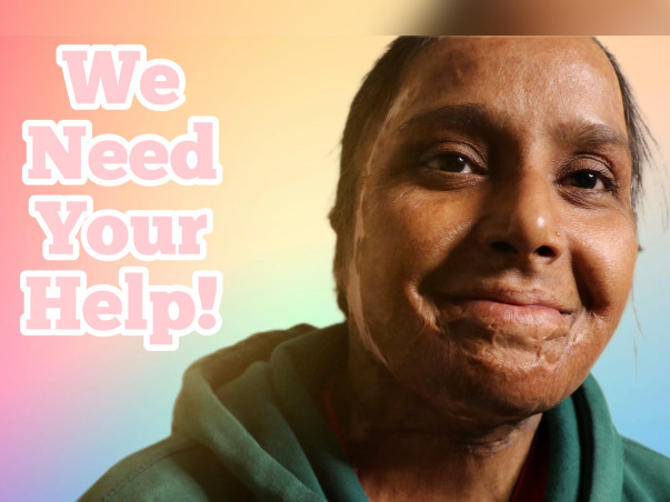 Help Empower Acid Attack Survivors