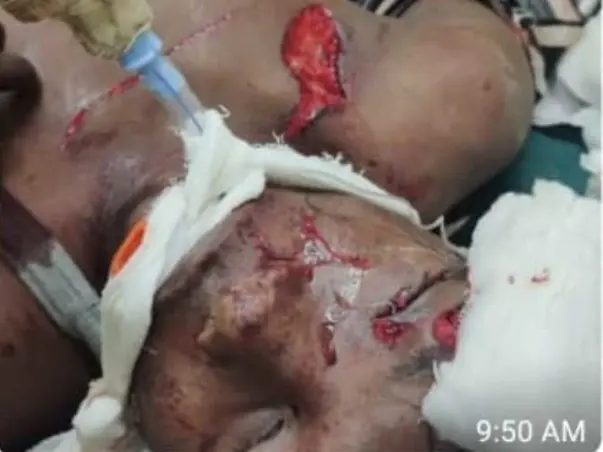 Help Prashanth To Recover From Accidental Injuries