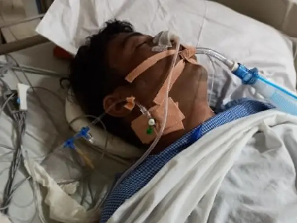 Help my friend Bhabani Prasad Nayak fight Brain surgery due to accident