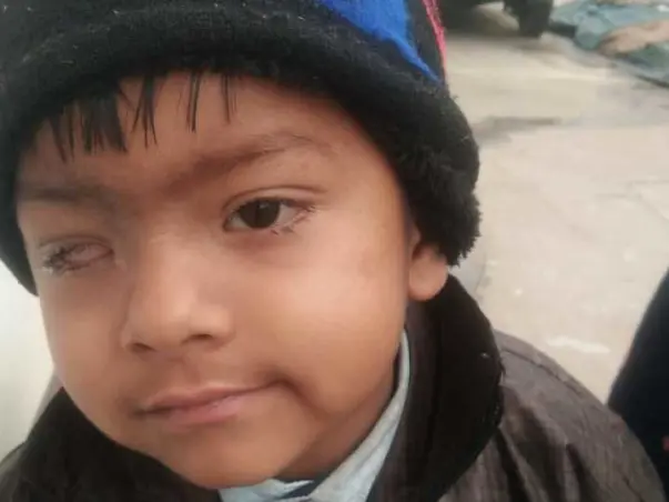 Devender's Baby Need Your Help