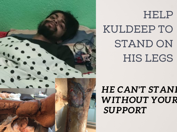 Help kuldeep to stand on his legs