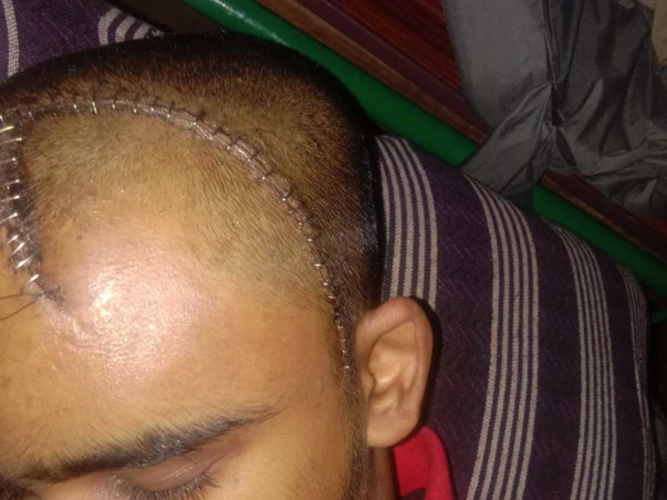 Support Akash Gowda G To Recover From Head Injury