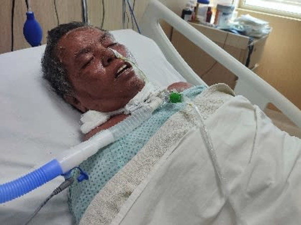 My Mother Needs Your Help To Recover From Septic shock