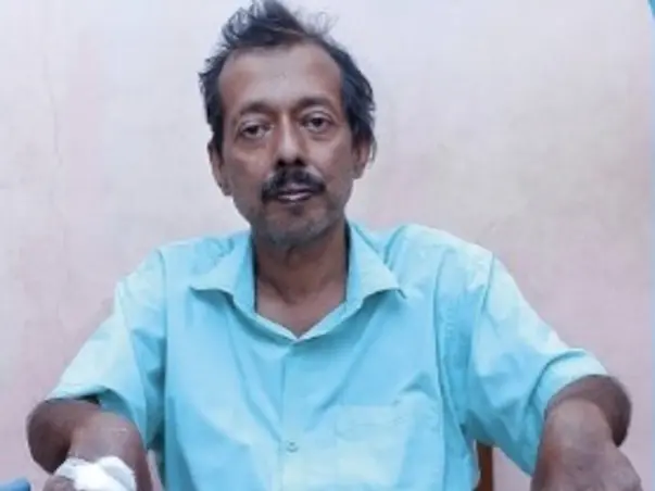 This 51 years old needs your urgent support in fighting liver cirrhosis