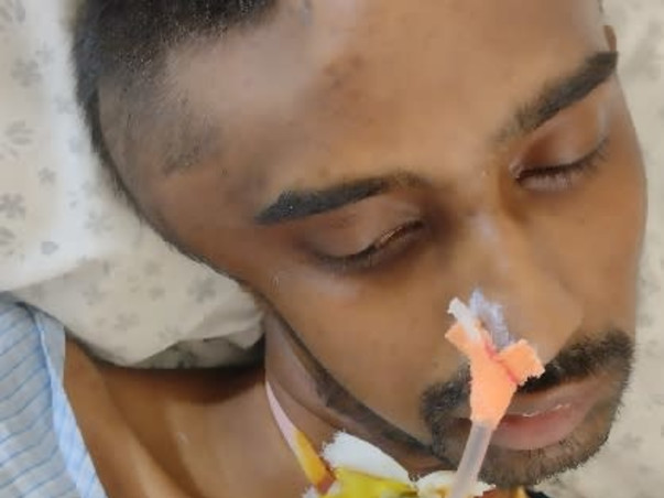 Help Ananda Mythreya Recover From CVA Right Capsule Ganglionic Bleed