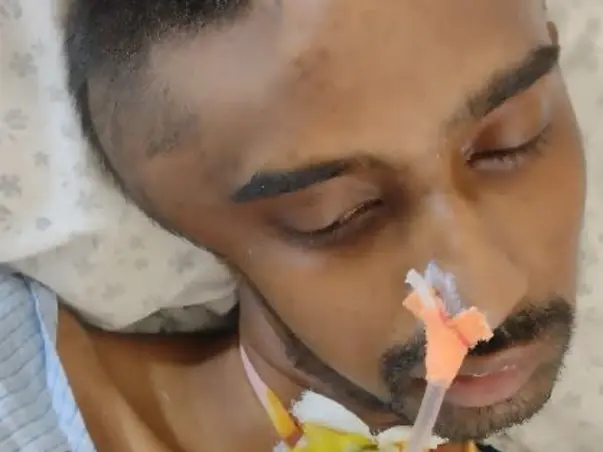 Help Ananda Mythreya Recover From CVA Right Capsule Ganglionic Bleed