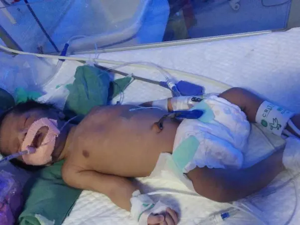 Help New Born to survive and see the beautiful creations