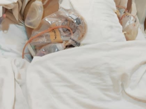 HELP for SYED MOHAMMED KAREEMULLA RAISE FUNDS to FIGHTS FOR CECAL VOLV