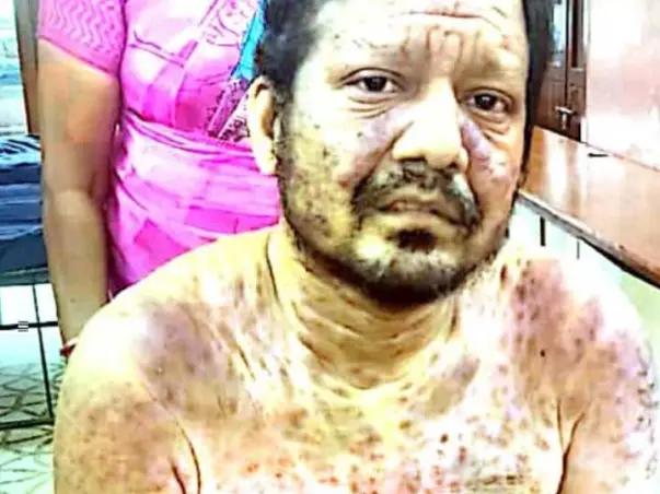 V. Ganesan