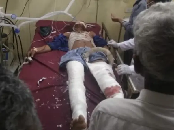 Help My Brother To Recover From Accidental Injuries