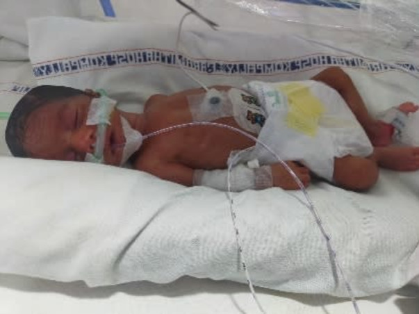Support Bhanu Priya Recover From Preterm Birth