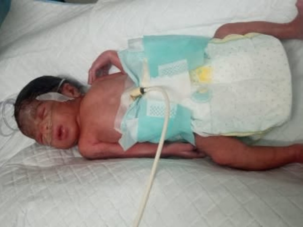 Support Bhanu Priya Recover From Preterm Birth