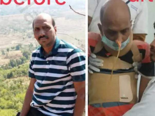 Support Swaminathan Iyer Recover From Pontine Stroke Double Hemiplegia