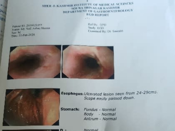 Support Ashiq Hussain Sofi Recover From Head And Neck Cancer