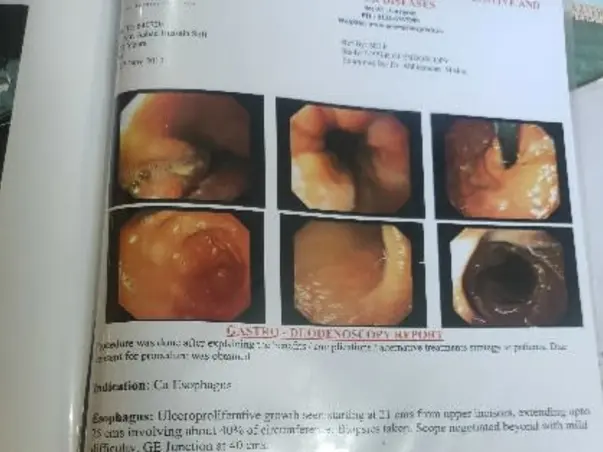 Support Ashiq Hussain Sofi Recover From Head And Neck Cancer