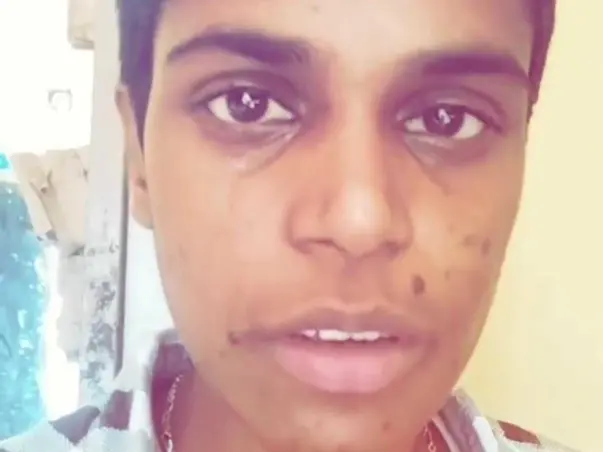 Help Saran Complete His Surgery