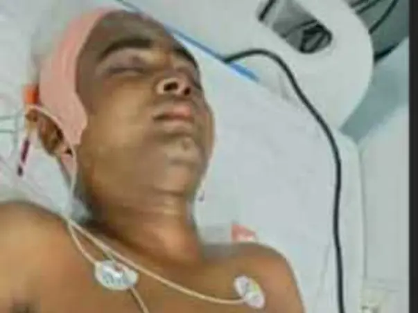 Support P Naresh Recover From Major Accident