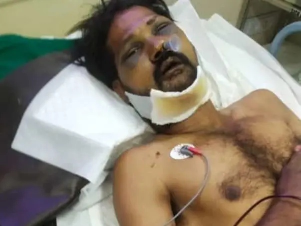 Santhosh Needs Your Help