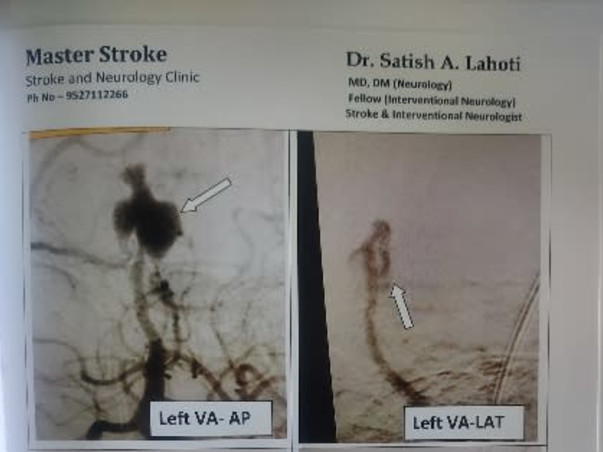 Support Rajini Kalambhe Recover From Neurosurgery