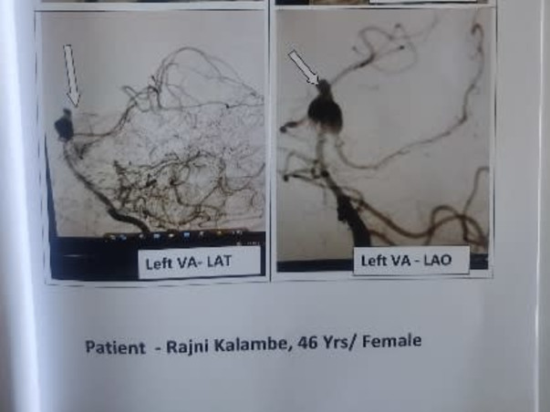 Support Rajini Kalambhe Recover From Neurosurgery