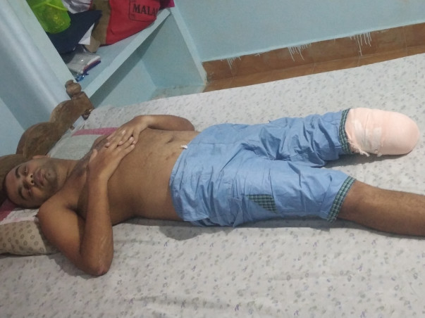 Support Vineeth Narayanan to recover from Amputation of left leg
