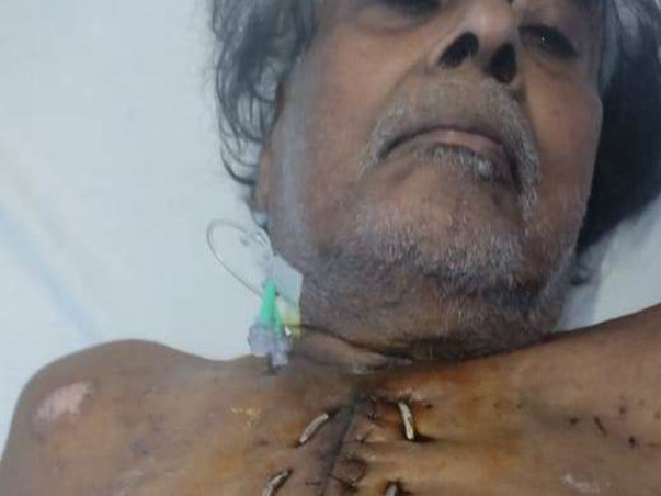 71 years old Balakrishnan needs your help fight Bypass