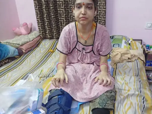 Support Deepthi Vollapalli Recover From Amyloid