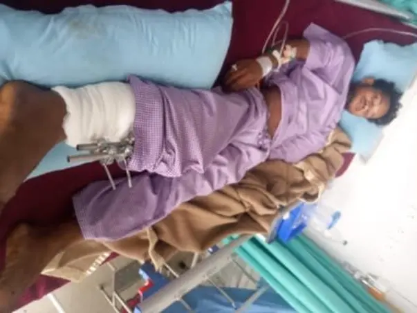 Ashik sabar is going through 2nd surgery