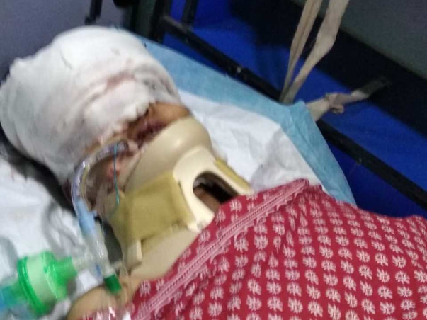 Help My wife Recover From blindness and Accidental facial Injuries