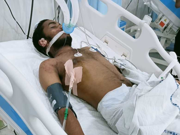 Support 17 Yr Old Suresh Doddi Fight Severe Accidental Injuries