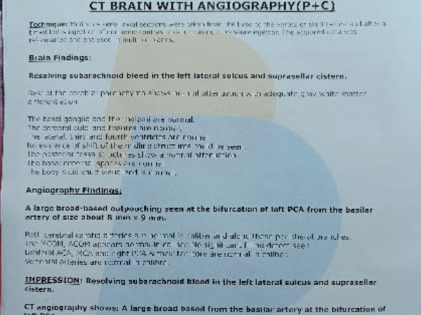 Kalpana mother of 2 daughters fighting with brain hammerage