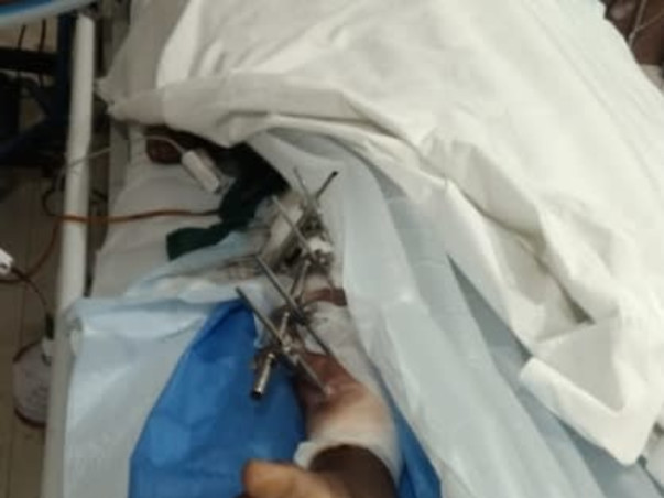 Help Our Friend Kondi Mahendra Recover From Accidental Injuries