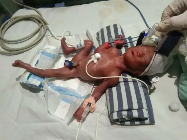 Selestin Needs Your Urgent Support In Fighting Premature Baby