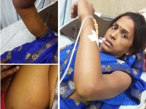 Help Pinky Devi To Recover from (Blood Infection) Cellulitis